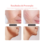 Massageador Facial Eletrico Pescoço Led Lift Fototerapia Ant - Imagem 5